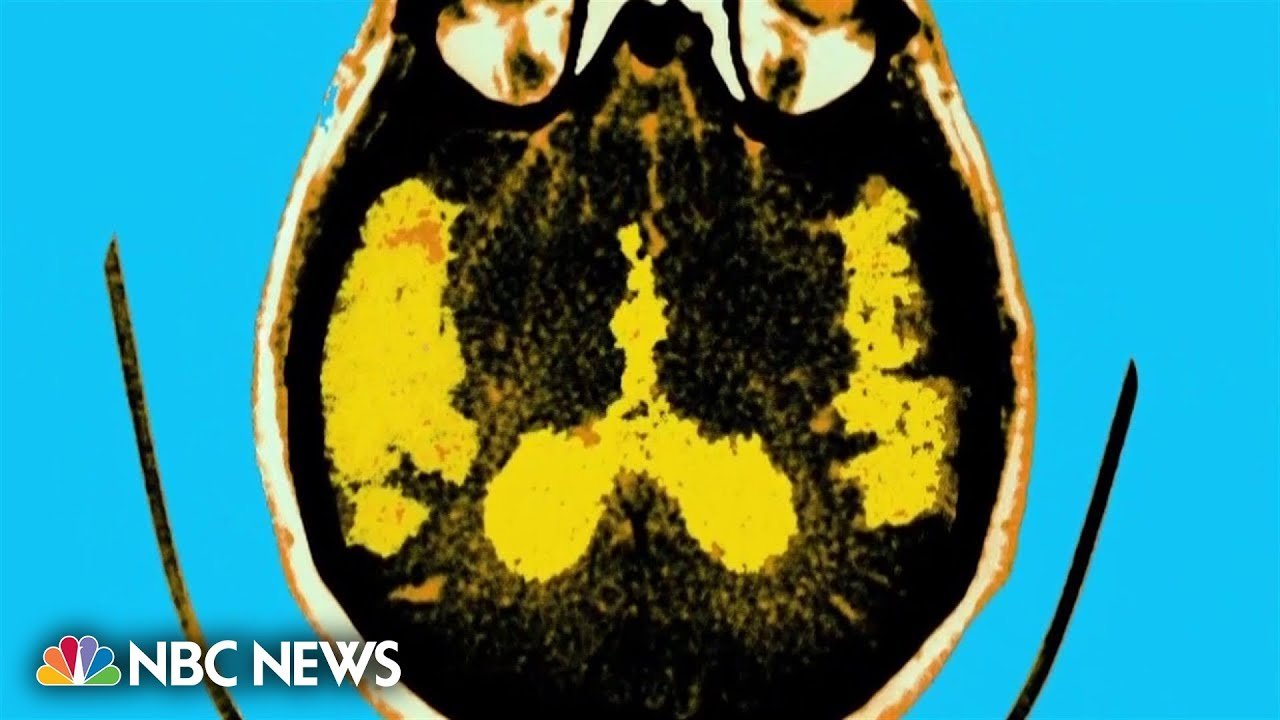 FDA grants first ever approval for Alzheimer’s drug meant to slow disease