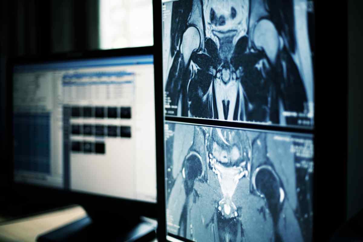 Top 10 Radiology Tech Softwares Revolutionizing Medical Imaging