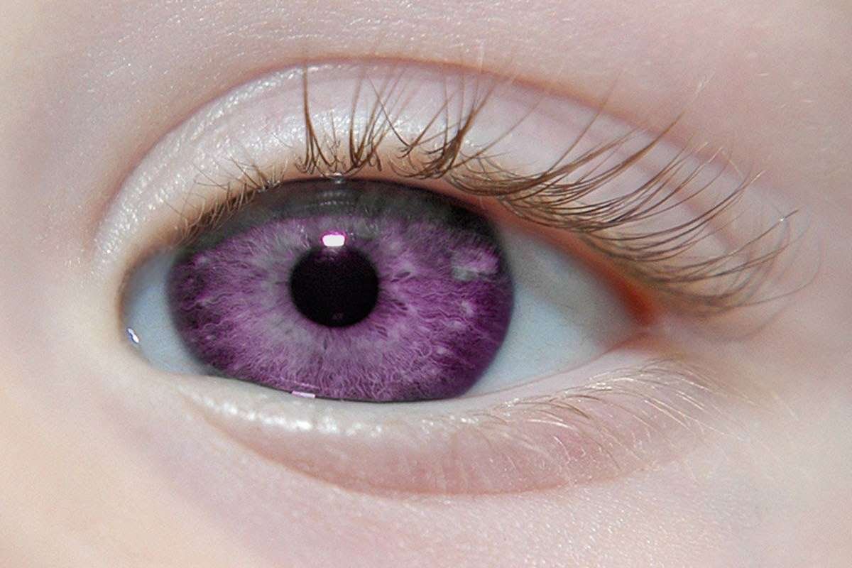 7 Rarest Eye Colors in the World- Nature’s Most Unique Shades | CIO Women Magazine